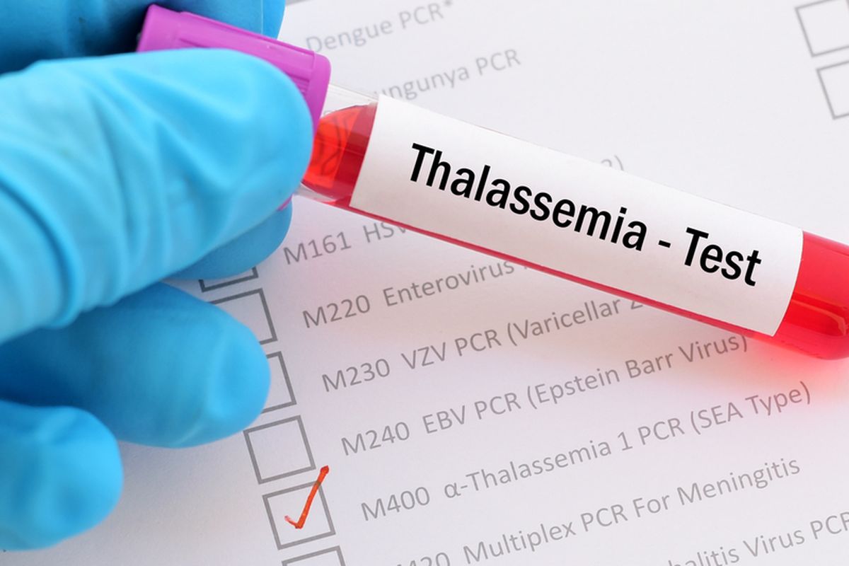 Talasemia Mayor: Panduan Perawatan Transfusi dan Terapi Chelation yang Perlu Diketahui