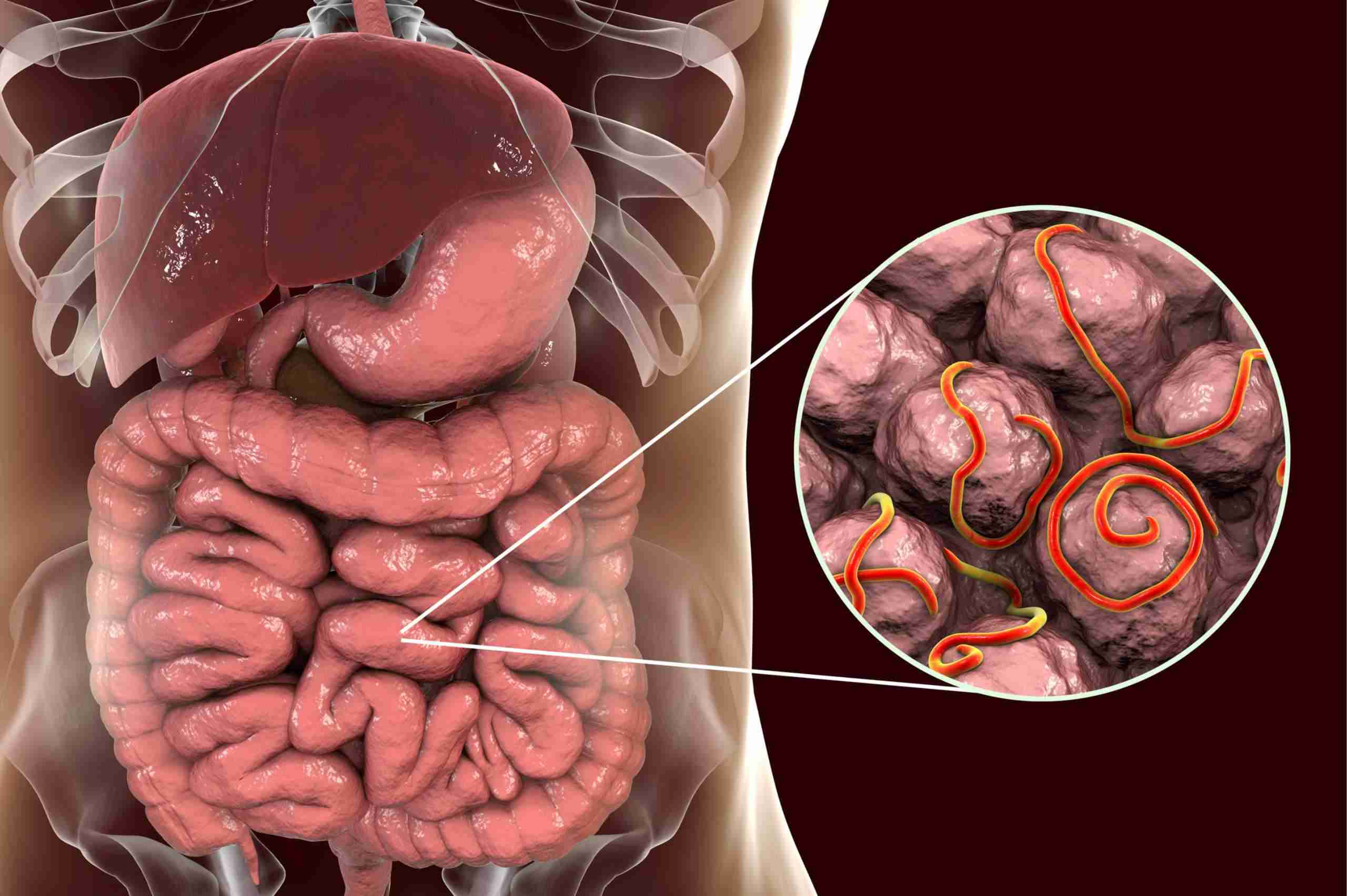 Cacingan Anak: Panduan Lengkap Perawatan di Rumah dan di Sekolah