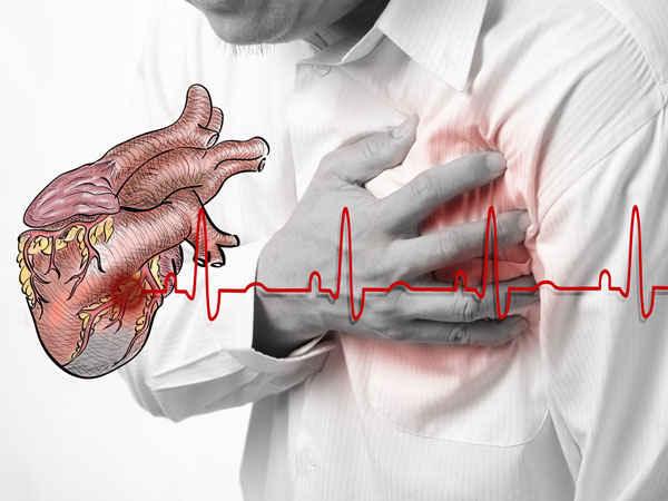 Aritmia Jantung: Panduan Deteksi Dini dengan Alat Wearable
