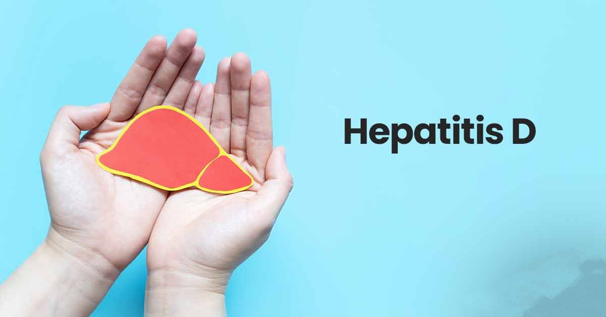 Hepatitis D