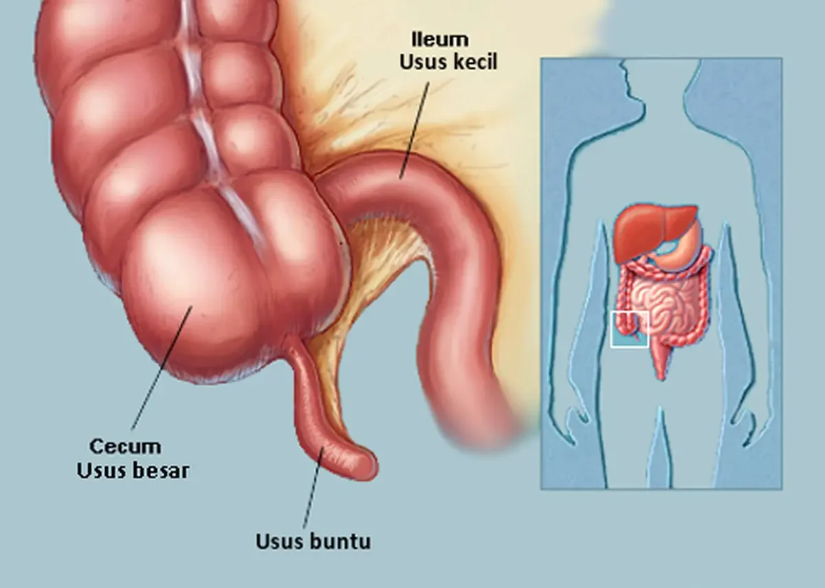 Usus Buntu