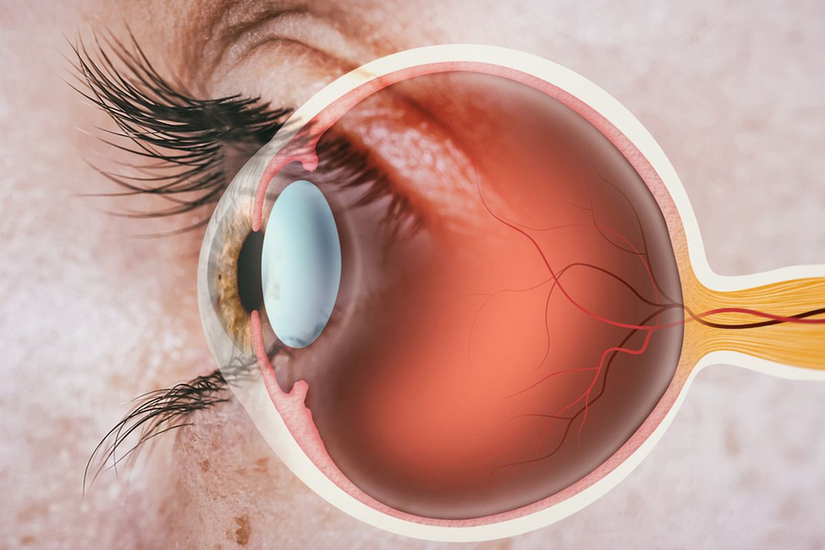 Saraf Optik