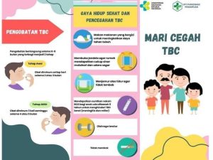 Cegah TBC