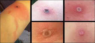 Borealpox Virus