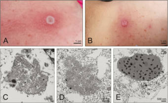 Borealpox Virus