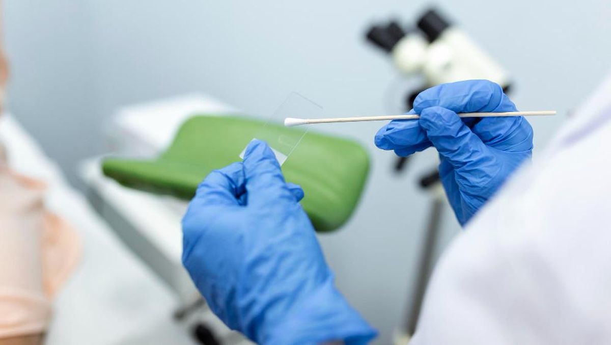 Pap Smear