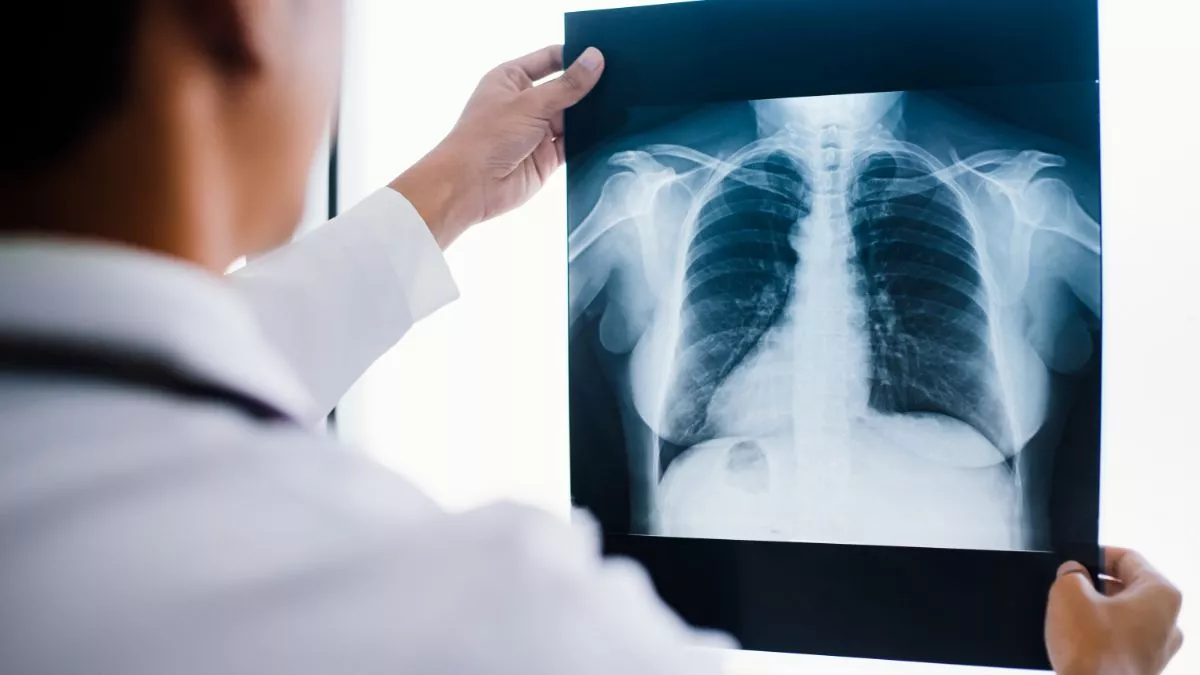Rontgen Thorax