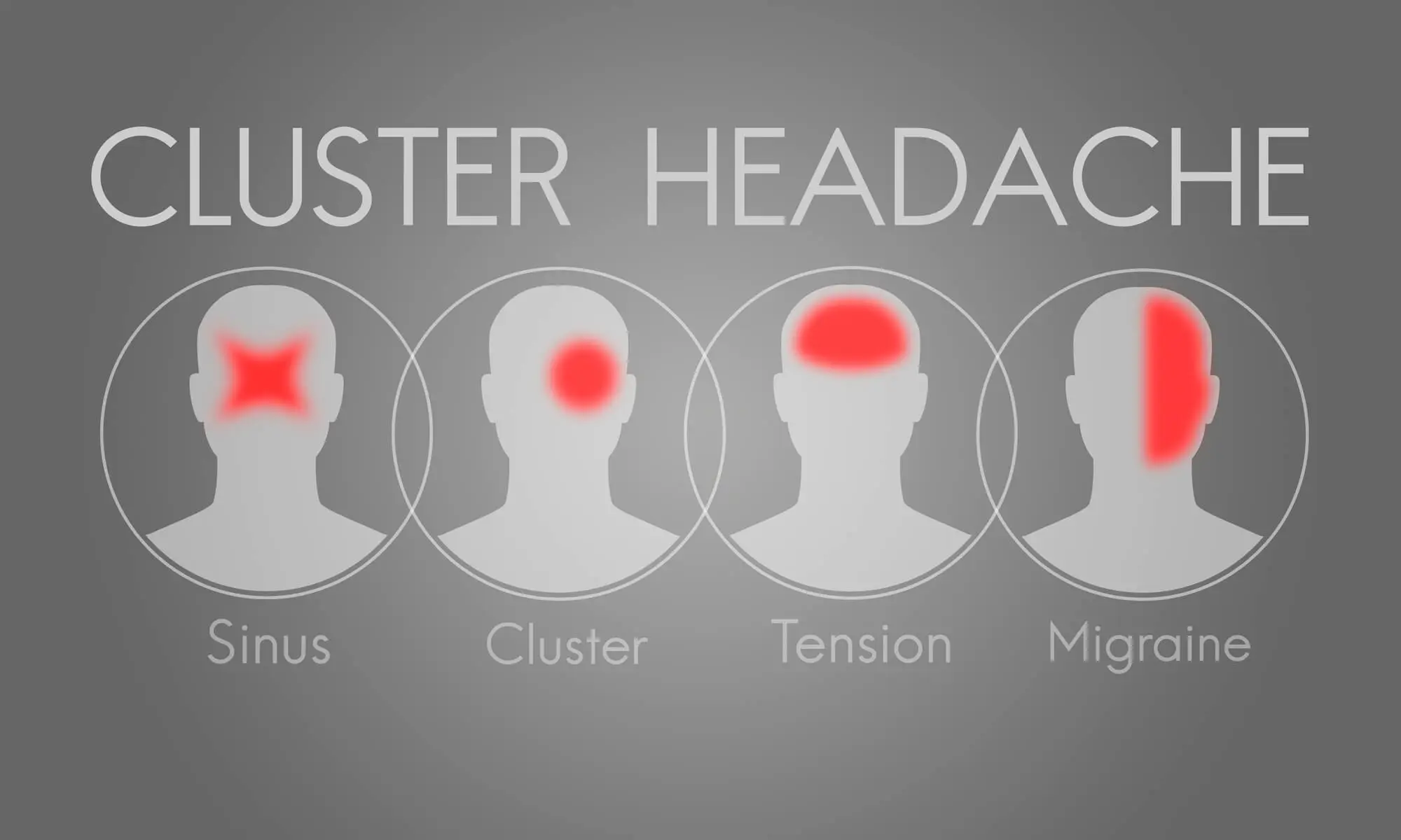 Cluster Headache