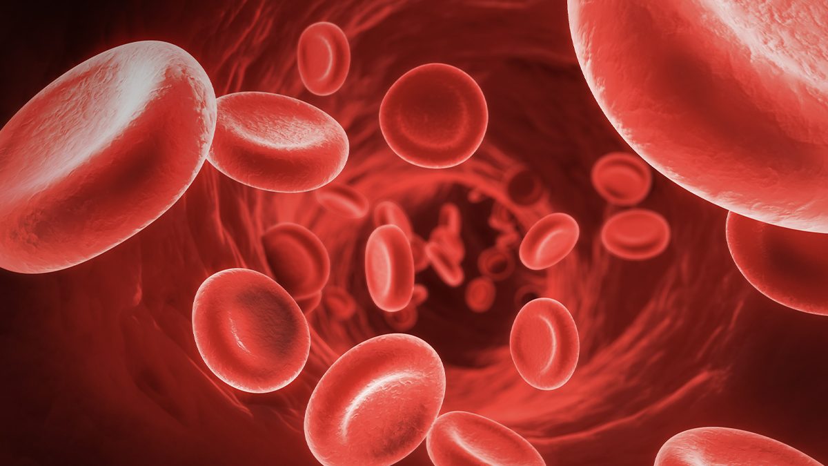 Anemia Hemolitik