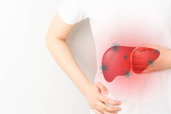 Gaucher Disease