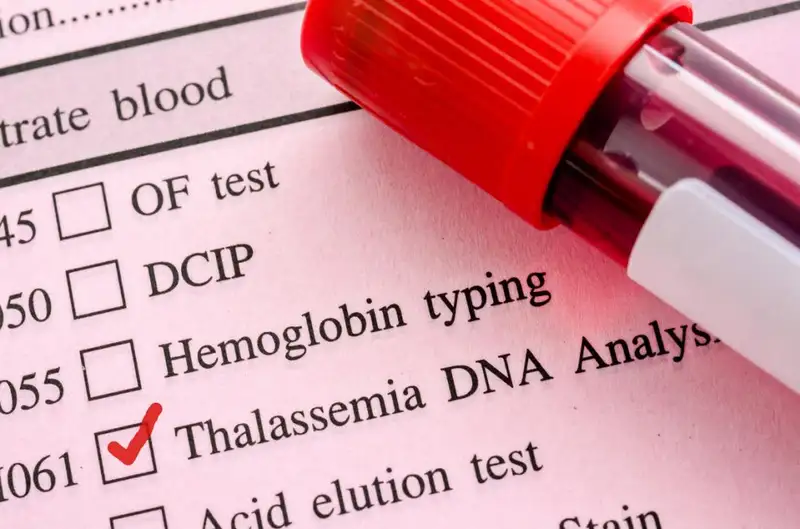 Anemia Hemolitik