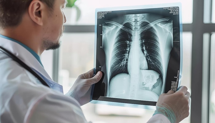 Rontgen Thorax