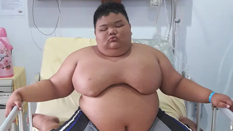 Obesitas Anak: Menggunakan Teknologi untuk Mendukung Hidup Sehat