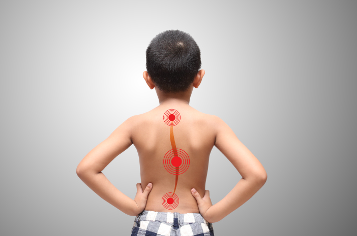 Skoliosis Anak: Panduan Lengkap untuk Orang Tua
