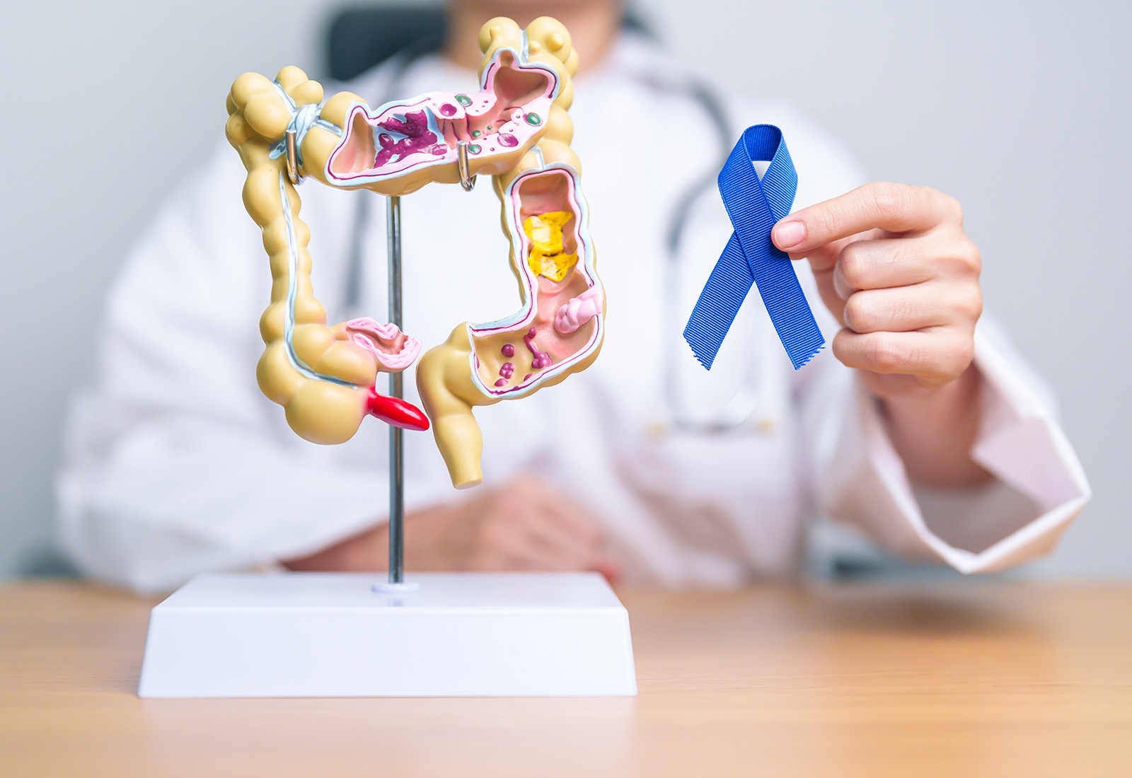 Pencegahan Kanker Usus: Makanan dan Minuman yang Menjaga Kesehatan Usus