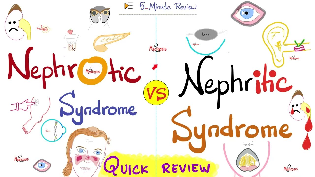 Syndrome Nephrotic