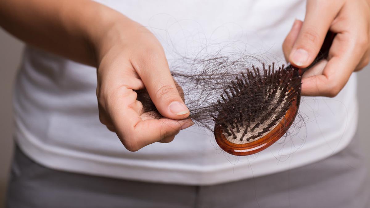 Kesehatan Rambut Rontok