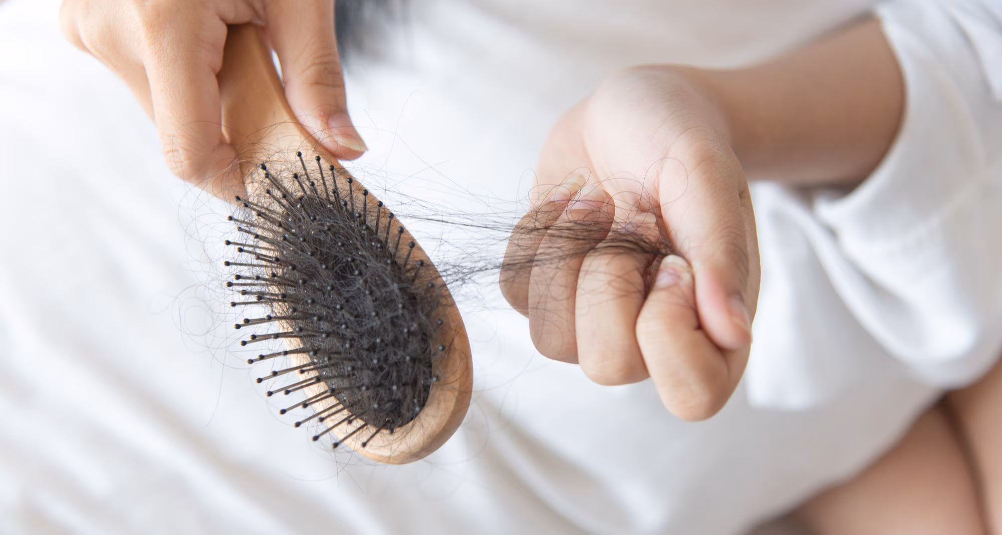 Kesehatan Rambut Rontok