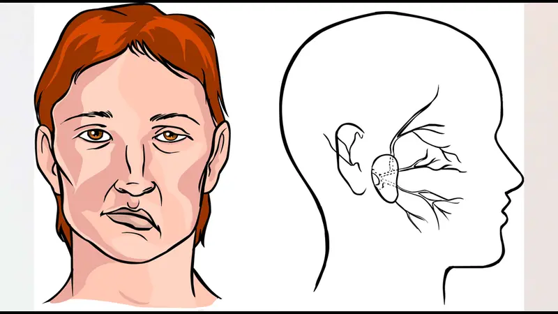 Gejala Penyakit Stroke: Panduan Lengkap untuk Semua Usia
