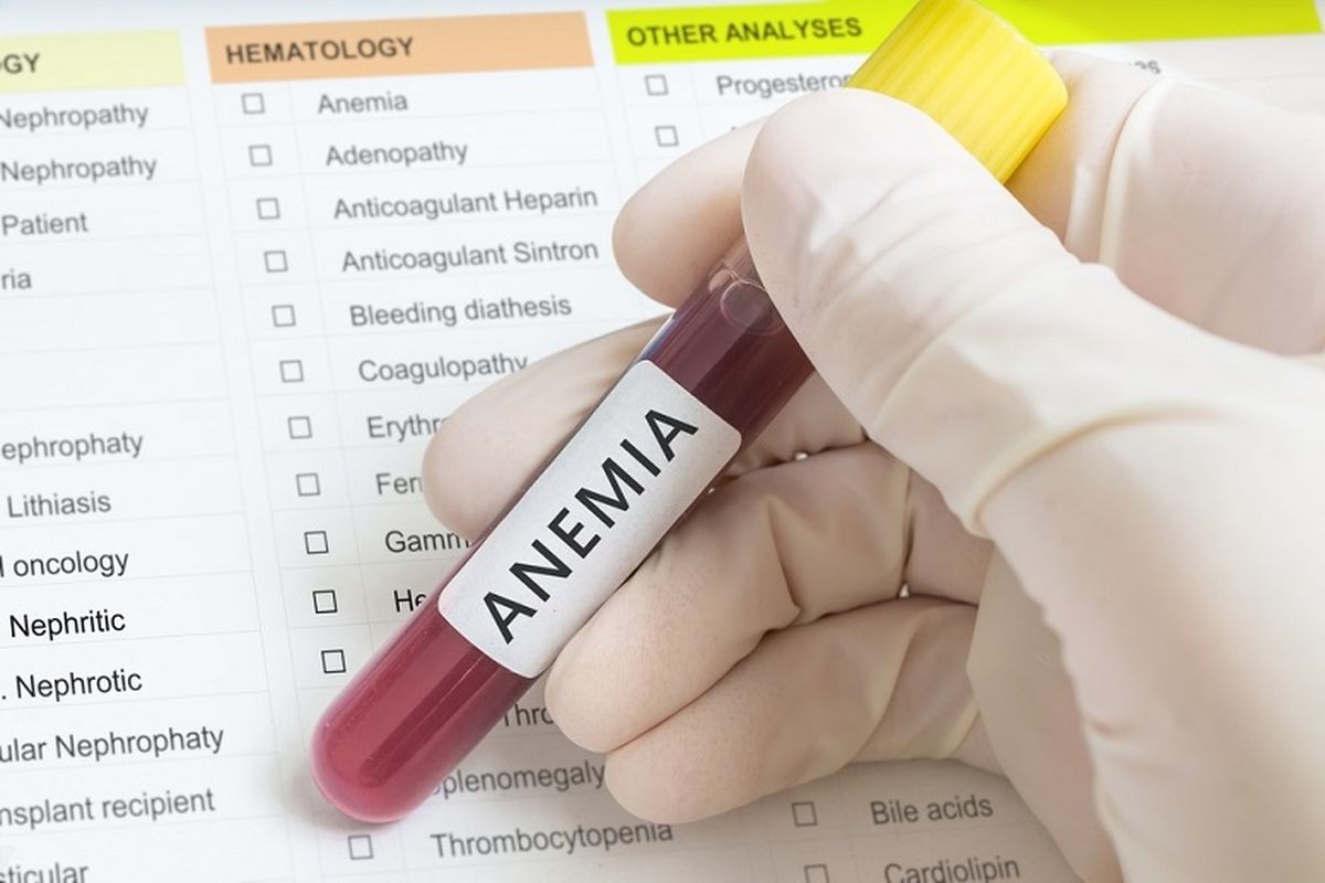 Anemia Defisiensi