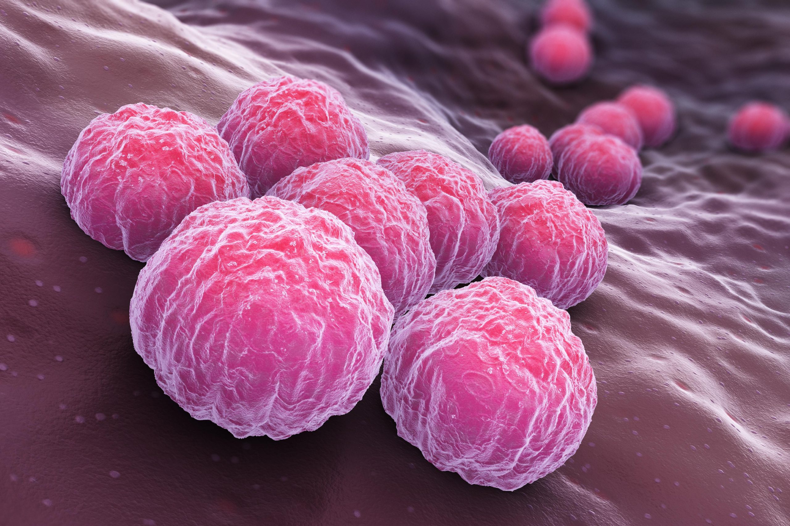 Klamidia