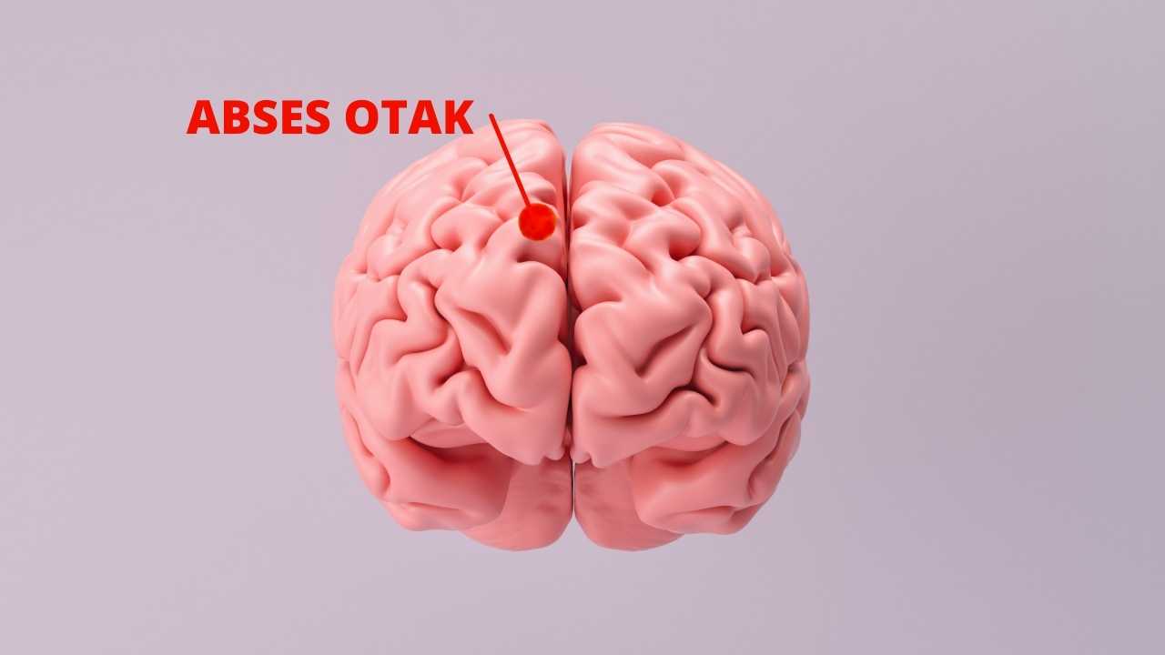 Abses Otak