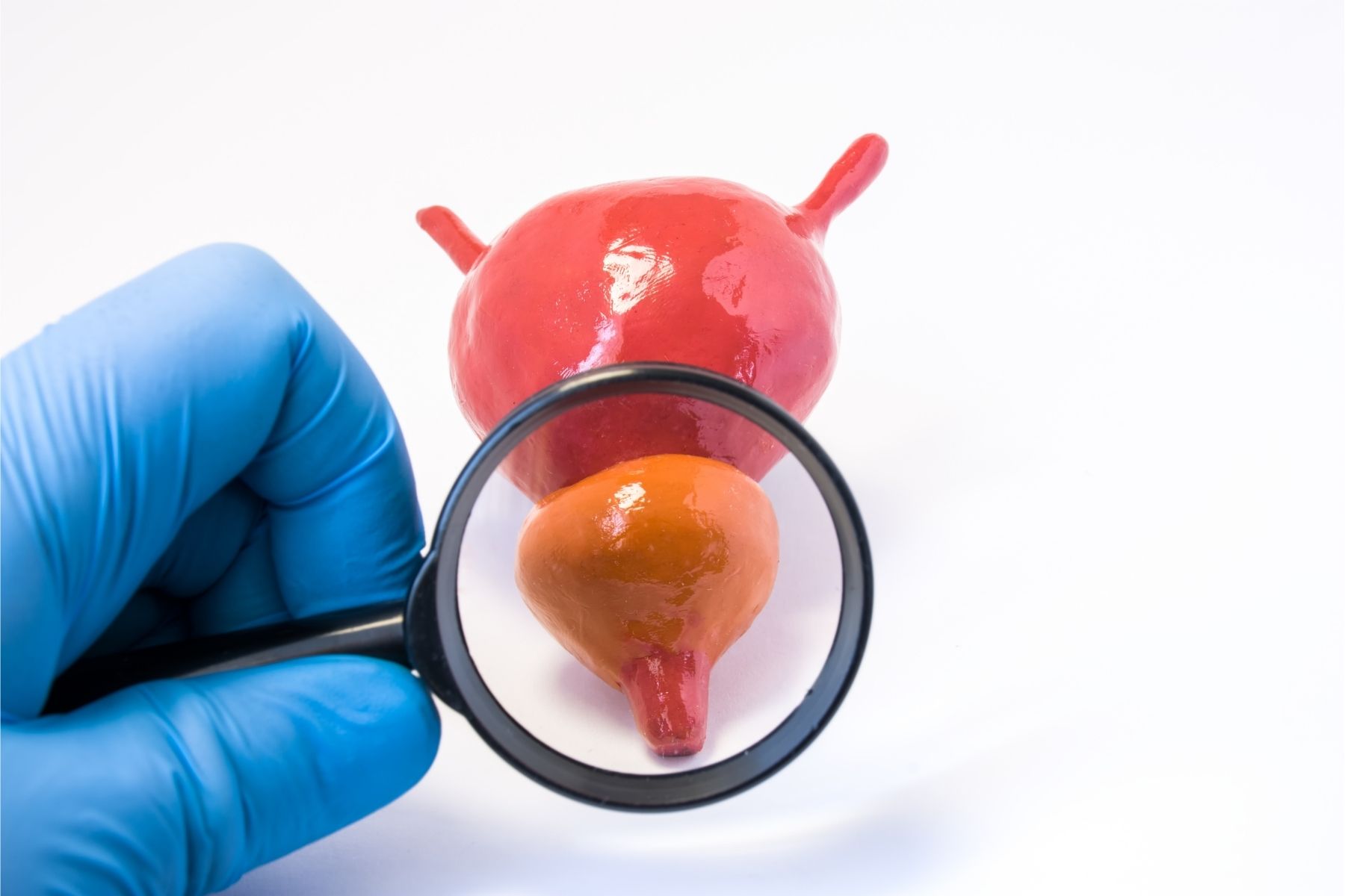Prostatitis