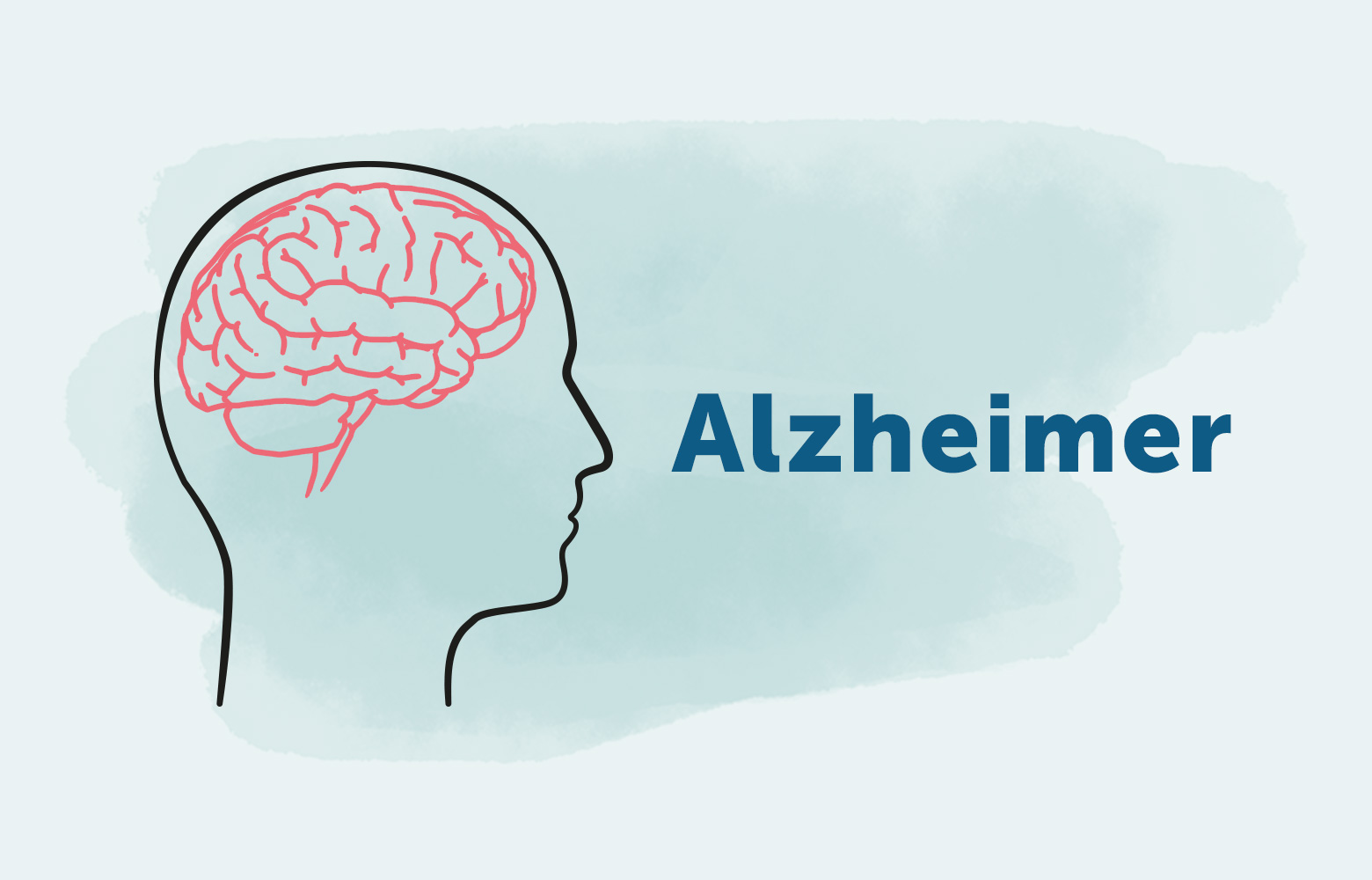 Penyakit Alzheimer