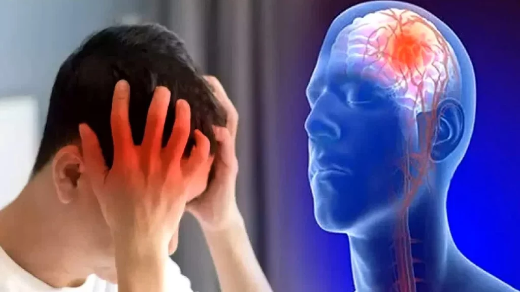 Stroke Iskemik Akut: Penanganan Medis Cepat untuk Keselamatan Nyawa
