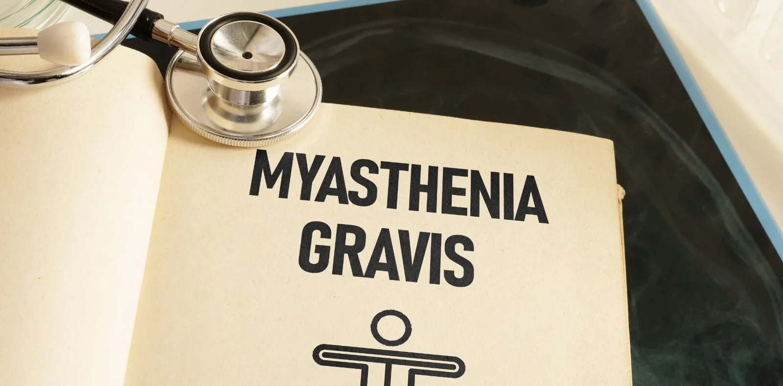 Myasthenia Gravis
