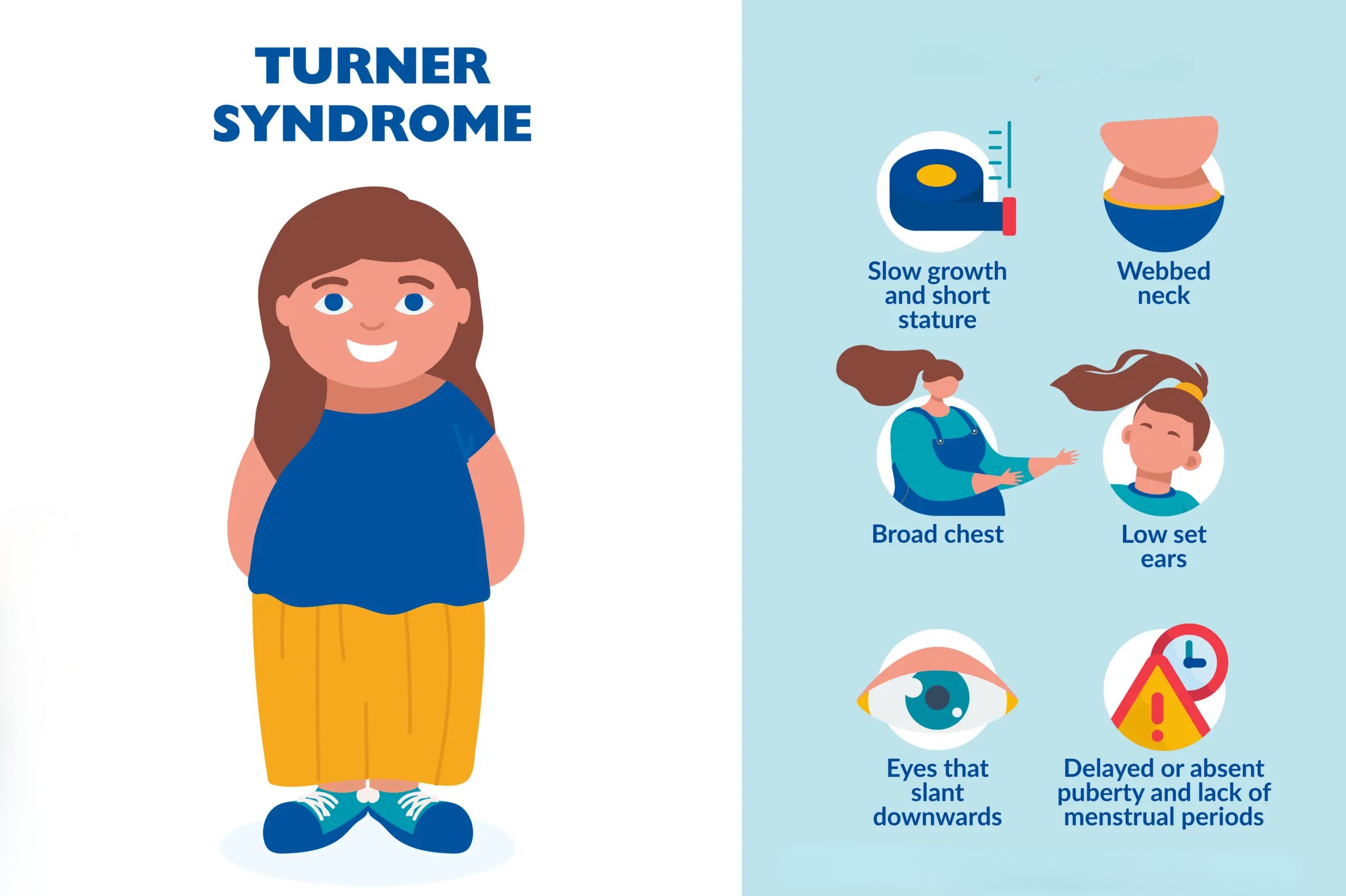 Sindrom Turner