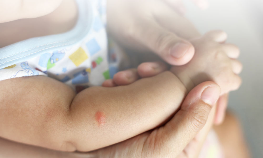 Gejala Demam Berdarah