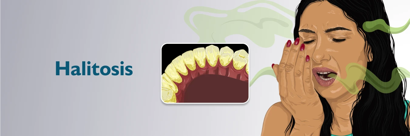 Halitosis