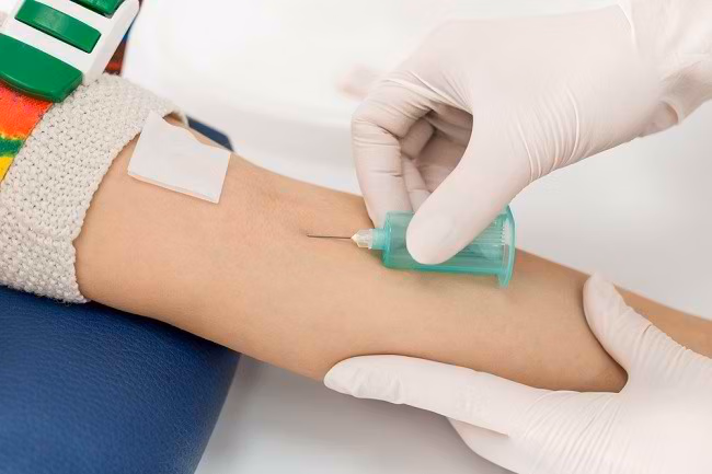 Pemeriksaan Fungsi Hati