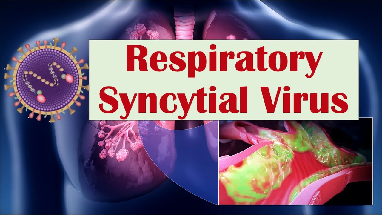 Respiratory Syncytial Virus