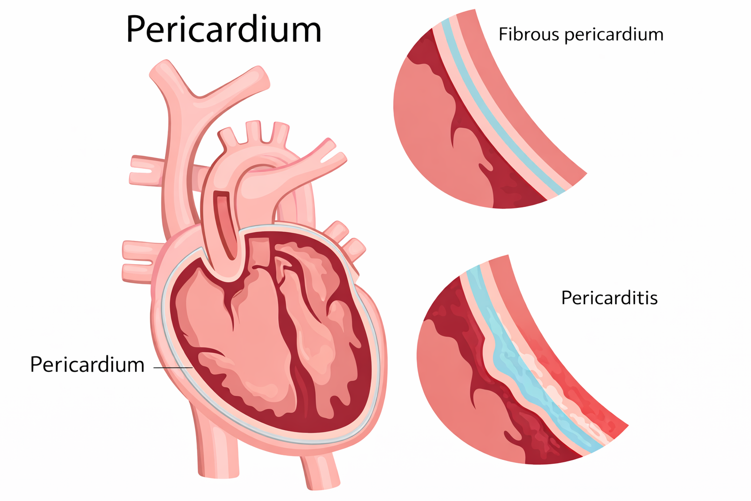 Perikardium