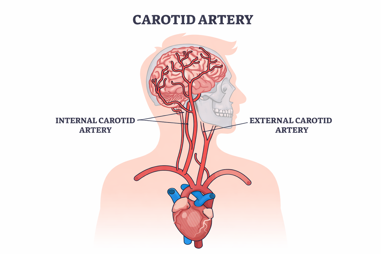 Arteri Karotis