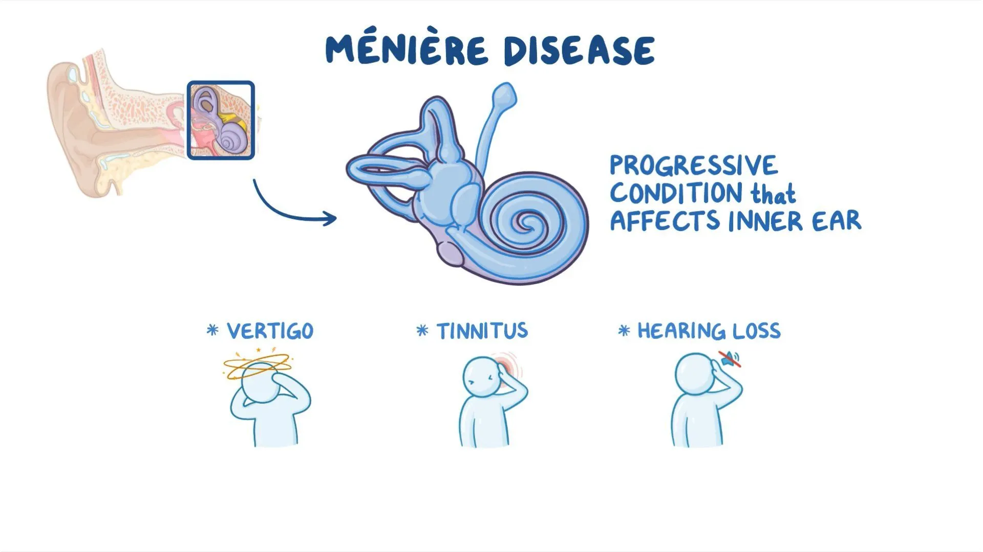 Meniere Disease