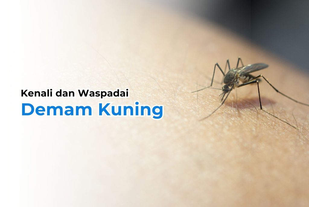 Demam Kuning