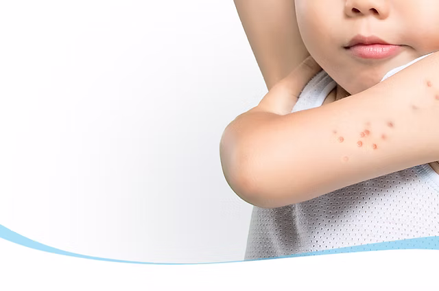 Molluscum Contagiosum