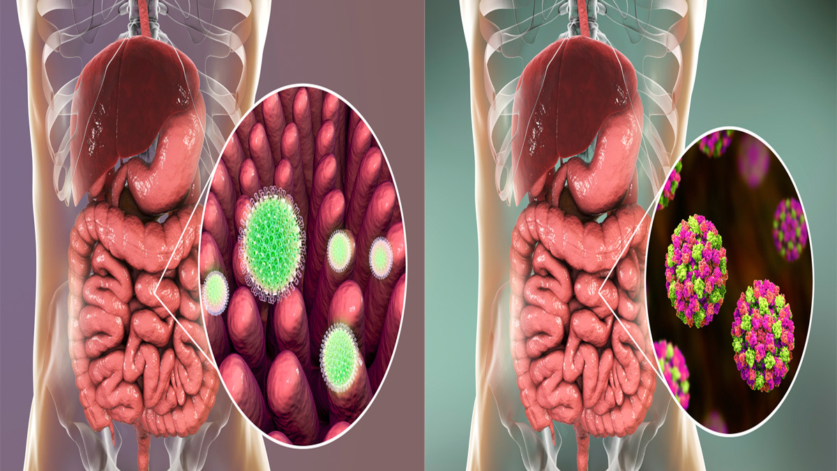 Norovirus