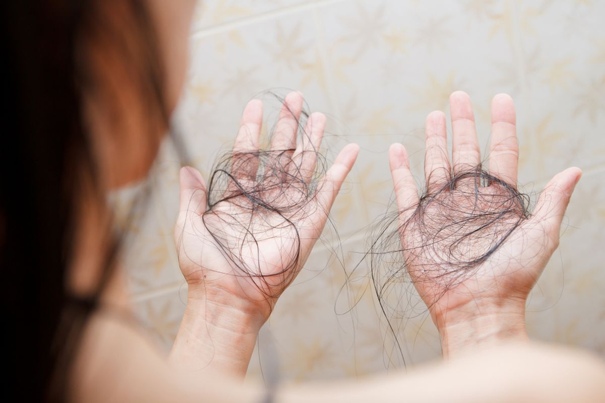 Cara Mengatasi Rambut Rontok