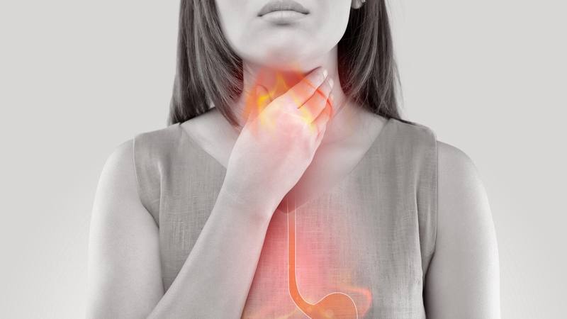Esofagitis Refluks