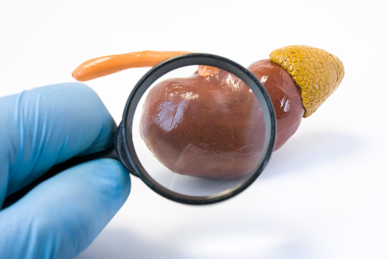 Sindrom Nefritis