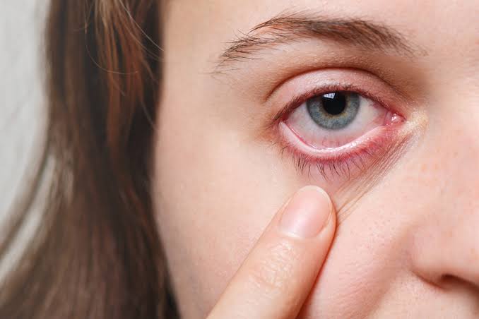 Koroiditis