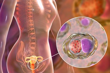 Chlamydia Trachomatis