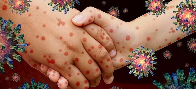 Enterovirus
