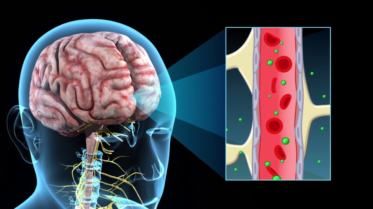Neuroinflamasi