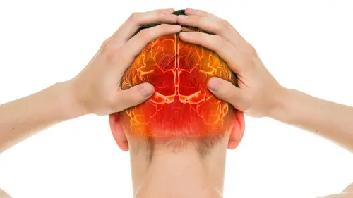 Neuralgia Oksipital