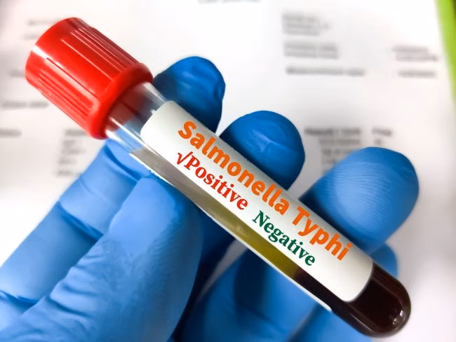 Salmonella Typhi